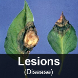 Lesions