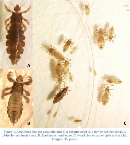 Head Lice Guide Causes Symptoms and Treatment Options
