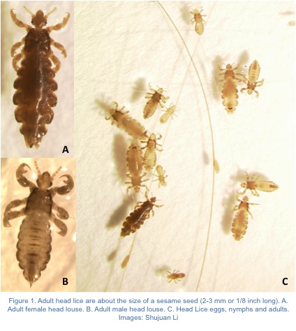 Head lice treatment: How to get rid of eggs and nits if shampoo or a comb  haven't worked