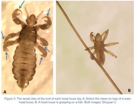 Head-Lice-Figure-3